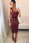 Sheath Knee Length Homecoming Dresses, Straps Lace Short Prom Dresses UQ1810